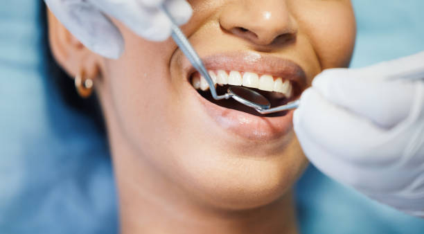Best Emergency Wisdom Teeth Removal in Timberne, LA