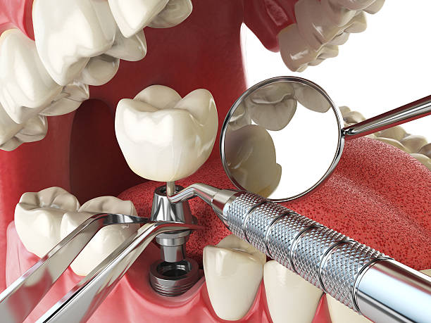  Timberne, LA Emergency Dentist Pros
