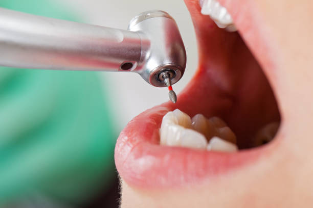 Best Emergency Dental Care for Trauma or Injury in Timberne, LA